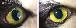 FIGURE 4. A -2.0D Fresnel lens structure is directly written into a live cat eye using a standard applanation procedure with 405 nm femtosecond laser pulses. Immediately after writing (a) a thin bubble layer is visible, clearing after 10–20 minutes. The eye shows a clear refractive structure after bubble clearing (b) and refractive corrections of this kind are stable for at least 18 months in live cats. FIGURE 4. A -2.0D Fresnel lens structure is directly written into a live cat eye using a standard applanation procedure with 405 nm femtosecond laser pulses. Immediately after writing (a) a thin bubble layer is visible, clearing after 10–20 minutes. The eye shows a clear refractive structure after bubble clearing (b) and refractive corrections of this kind are stable for at least 18 months in live cats.