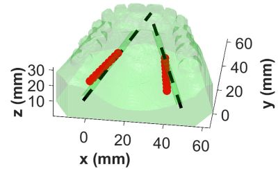 Content Dam Bow En Articles 2018 06 Diffuse Optical Imaging Maps Arteries To Improve Oral Surgery Outcomes Leftcolumn Article Thumbnailimage File