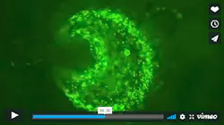 This still from a short video shows how the camera will image the uptake of cancer drugs into tumors, advancing cancer therapy. This still from a short video shows how the camera will image the uptake of cancer drugs into tumors, advancing cancer therapy.