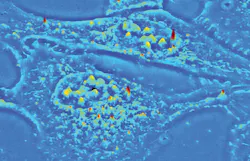 A 3D surface projection of live U-2 OS cell from a SLIM quantitative phase image is shown. A 3D surface projection of live U-2 OS cell from a SLIM quantitative phase image is shown.