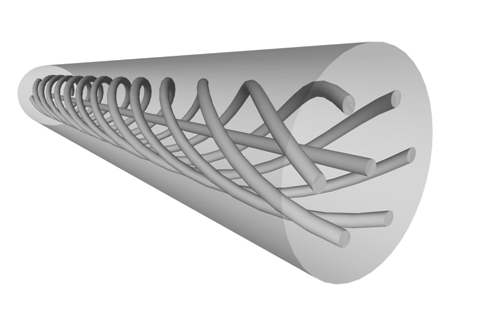 FIGURE 1. Three-dimensional shape sensing promises to facilitate procedures such as coronary angioplasty with highly accurate GPS-like guidance provided by feedback from the optical fiber, which exhibits strain when bent; this application is enabled by a highly complex optical fiber such as the spun seven-core SM-7C 1500(6.1/125).