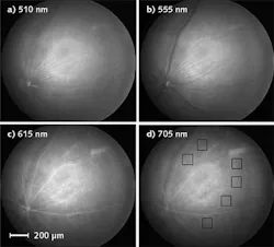 Monochromatic images of a mouse retina are displayed at four different wavelengths (boxes indicate locations of amyloid measurement areas). Illumination with 510 nm blue light (a) shows bright reflections from nerve fibers and blood vessels. The 555 nm green light images (b) show dark large blood vessels, while nerve fibers in the center appear bright (veins are darker than arteries because of greater deoxyhemoglobin absorption). The 615 nm red light images (c) show bright arteries and veins, while 705 nm near-infrared light (d) reveals less-bright vessels but more sharply focused choroidal capillaries near the center. Monochromatic images of a mouse retina are displayed at four different wavelengths (boxes indicate locations of amyloid measurement areas). Illumination with 510 nm blue light (a) shows bright reflections from nerve fibers and blood vessels. The 555 nm green light images (b) show dark large blood vessels, while nerve fibers in the center appear bright (veins are darker than arteries because of greater deoxyhemoglobin absorption). The 615 nm red light images (c) show bright arteries and veins, while 705 nm near-infrared light (d) reveals less-bright vessels but more sharply focused choroidal capillaries near the center.