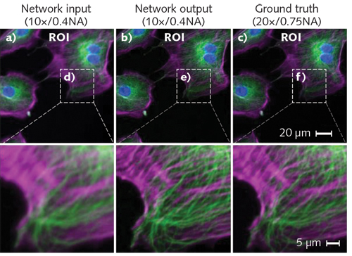 A laptop-based deep learning system converts low-resolution fluorescence microscopy images (a) into superresolution images (b) that compare favorably with images produced using high-resolution equipment (c); images on the bottom row depict detail from those on the top row.