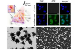 Content Dam Bow Online Articles 2019 02 Nanostars Laser Content Dam Bow Online Articles 2019 02 Nanostars Laser