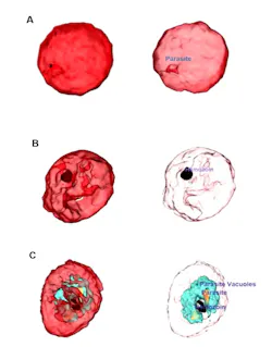 Tomocube Plasmodium Falciparum Rb Cs 5d556d3dc68ca Tomocube Plasmodium Falciparum Rb Cs 5d556d3dc68ca