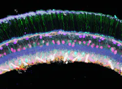 Mouse Retina Cryosections 5d5d962a5bf72 Mouse Retina Cryosections 5d5d962a5bf72
