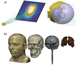 FIGURE 1. These freeform optics were designed in LightTools (a). The software can help identify manufacturing tolerances for tailored surfaces used in freeform optics for illumination. Head models are created from image data using Synopsys Simpleware software (b). Simpleware can be used in conjunction with LightTools to run detailed optical scenarios in 3D anatomical models for biomedical applications. FIGURE 1. These freeform optics were designed in LightTools (a). The software can help identify manufacturing tolerances for tailored surfaces used in freeform optics for illumination. Head models are created from image data using Synopsys Simpleware software (b). Simpleware can be used in conjunction with LightTools to run detailed optical scenarios in 3D anatomical models for biomedical applications.