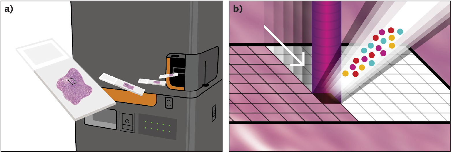 FIGURE 1. Imaging Mass Cytometry (IMC) begins with the user loading a slide prepared with an antibody-stained specimen into the Hyperion Imaging System and using system controls to select a region of interest to be imaged (a). The system&rsquo;s pulsed laser, operating at 213 nm, enables precise imaging: The beam, focused at 1 &micro;m diameter, samples proteins stained with metal-tagged antibodies and directs these tags to analysis by inductively coupled time-of-flight (ToF) technology. This occurs in a single scan as the laser samples each squared-micron pixel in the selected region (b).