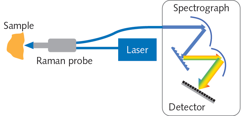 FIGURE 1. The key components of a Raman spectroscopy system are the laser, detector, spectrograph, and probe.