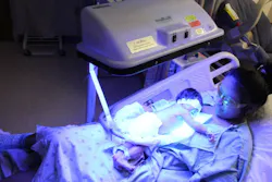 FIGURE 2. Wrapping a baby with jaundice in a fiber-optic 'biliblanket' illuminates its skin with blue light, helping the child's body break down harmful bilirubin. FIGURE 2. Wrapping a baby with jaundice in a fiber-optic 'biliblanket' illuminates its skin with blue light, helping the child's body break down harmful bilirubin.