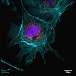 An example of an image taken in a single-molecule localization microscopy (SMLM) setup from the Department of Biotechnology & Biophysics at Julius-Maximilian-University of Würzburg; the three-color image is a BPAE cell with mitotracker (red), actin (cyan), and nucleus (DAPI; blue) staining (recording time: 4 s per channel, with 2048 × 2048 pixel image detail). An example of an image taken in a single-molecule localization microscopy (SMLM) setup from the Department of Biotechnology & Biophysics at Julius-Maximilian-University of Würzburg; the three-color image is a BPAE cell with mitotracker (red), actin (cyan), and nucleus (DAPI; blue) staining (recording time: 4 s per channel, with 2048 × 2048 pixel image detail).