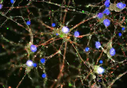 Imaging studies found C4 (green) at synapses (red and white) of cultured human neurons (blue). Imaging studies found C4 (green) at synapses (red and white) of cultured human neurons (blue).