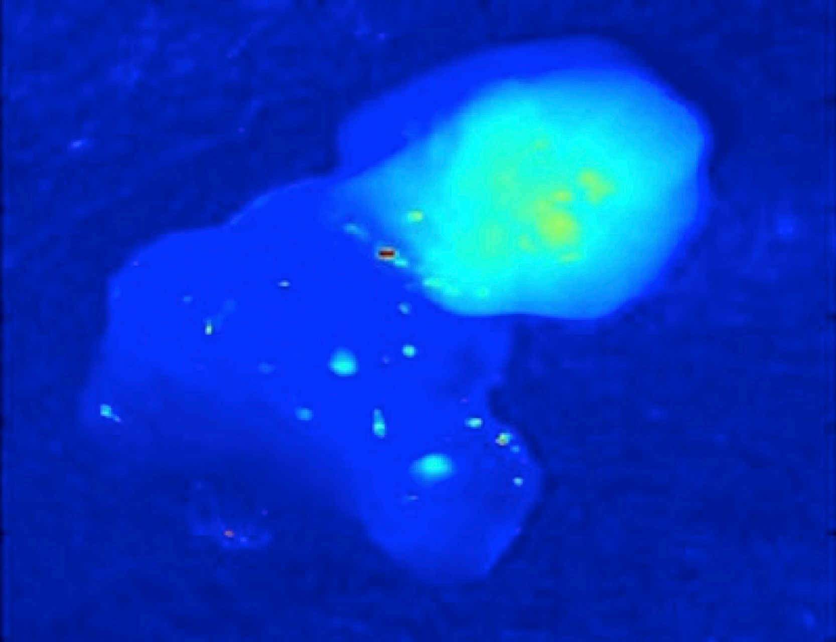 Parathyroid tissue (upper right) autofluoresces under near-IR light at significantly greater intensity than does any other tissue in the neck.