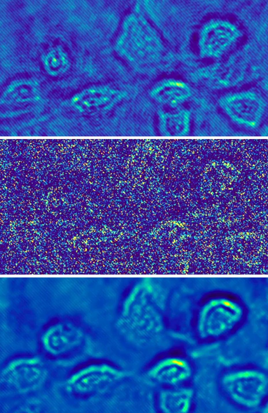 A hologram of fibroblast cells taken at a light intensity substantially above the shot-noise limit has relatively low noise (top). A shot-noise-limited hologram of the fibroblast cells has obvious high noise (center). A Holo-UNet-restored shot-noise-limited hologram has an image quality comparable to the hologram taken at a high intensity. These images are stills from an ANU video that can be found at https://youtu.be/nNkcdZsveHQ.