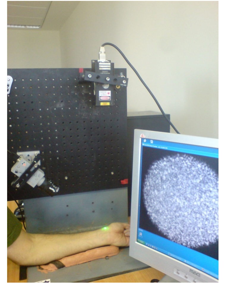 A noninvasive blood glucose, blood pressure, and heart-rate monitoring technique is based on the optical analysis of speckle patterns or &ldquo;vibrations&rdquo; reflected from human skin.