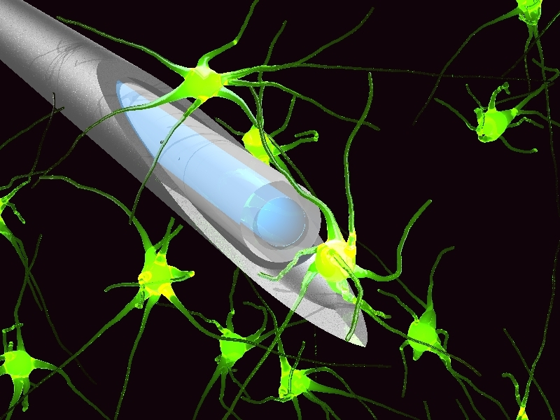 A single multimode fiber serves as an in vivo neuroimager; image information carried by its multiple modes is unscrambled by a spatial light modulator at the other end of the fiber.