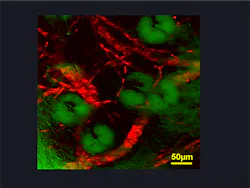 A stimulated-emission image of microcapillaries of a mouse ear based on endogenous hemoglobin contrast (in red color) shows individual blood cells in the vessel network surrounding sebaceous glands (green overlay based on confocal reflectance). A stimulated-emission image of microcapillaries of a mouse ear based on endogenous hemoglobin contrast (in red color) shows individual blood cells in the vessel network surrounding sebaceous glands (green overlay based on confocal reflectance).