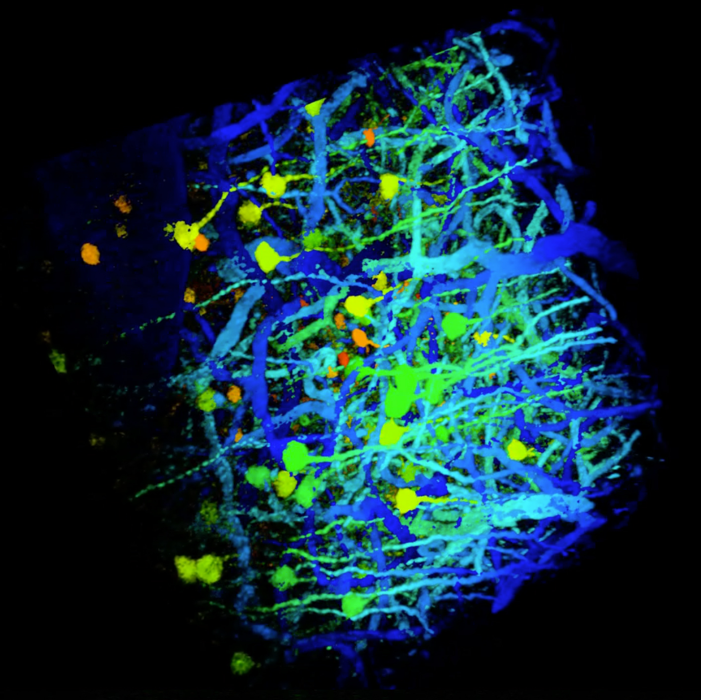 Enabled by new light sources providing maximum flexibility for optimizing parameters, three-photon microscopy allows nondestructive imaging deep into a wide variety of specimens. This micrograph was acquired at 1330 nm (3 MHz) using a fiber laser designed to optimize three-photon fluorescence excitation in multiphoton imaging (KMLabs&rsquo; Y-Fi OPA); it shows mouse brain vasculature and neurons (labeled with fluorescein isothiocyanate-conjugated dextran and green fluorescent protein, respectively).