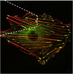 FIGURE 3. A stack of 20 planes was used to create this three-dimensional confocal image of a vascular smooth muscle cell transfected with pGFP-vinculin and pmRFP-actin. The white dashed lines represent the AFM tip above the cell surface. FIGURE 3. A stack of 20 planes was used to create this three-dimensional confocal image of a vascular smooth muscle cell transfected with pGFP-vinculin and pmRFP-actin. The white dashed lines represent the AFM tip above the cell surface.