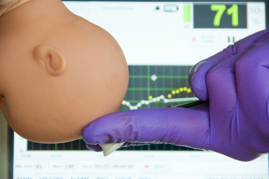 Noninvasix's optoacoustic-based probe monitors cerebral venous oxygenation in the superior sagittal sinus of the emerging baby's skull, to accurately assess the amount of oxygen a baby is receiving.