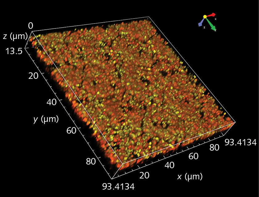 This isometric image of mouse retinal pigment epithelium was taken with 561 nm excitation and no emission filter on a modified confocal microscope. Green melanosomes are easily distinguished from golden-yellow lipofuscin granules.