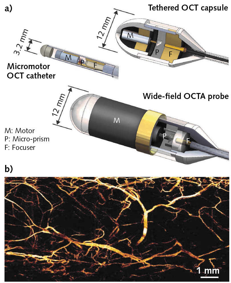 Fiber-coupled endoscopic probes scan surrounding tissue at high rates, enabled by a megahertz-range MEMS-VCSEL variable wavelength source (a). The high rates enable angiographic imaging without administering any contrast agent, as in the image of swine esophagus vasculature shown here (b).