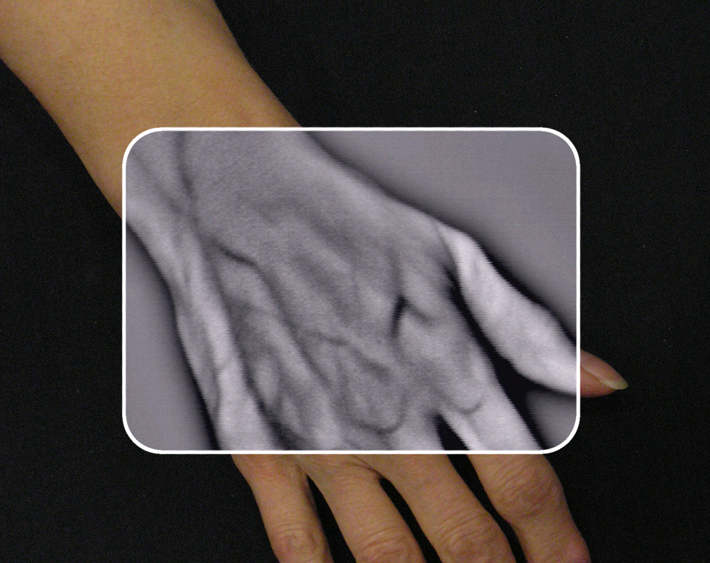 FIGURE 1. VueTek Scientific wanted to develop a portable vascular imaging product that would allow a medical practitioner to visualize and observe subcutaneous vasculature in real time.