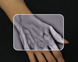 FIGURE 1. VueTek Scientific wanted to develop a portable vascular imaging product that would allow a medical practitioner to visualize and observe subcutaneous vasculature in real time. FIGURE 1. VueTek Scientific wanted to develop a portable vascular imaging product that would allow a medical practitioner to visualize and observe subcutaneous vasculature in real time.