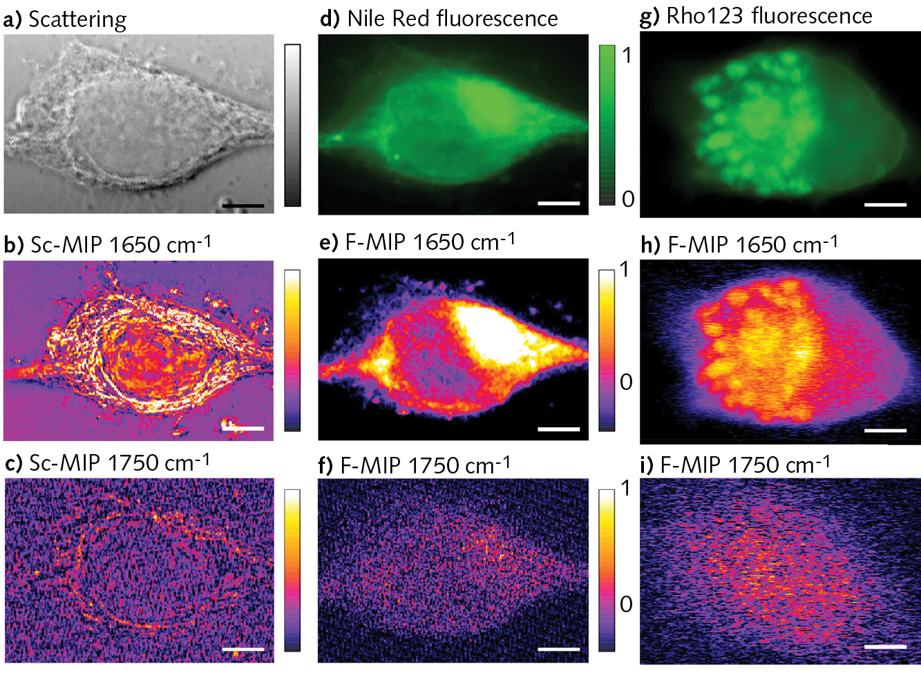 FIGURE 3. Images of living MiaPaca2 cancer cells: Scattering image (a); O-PTIR image at 1650 cm-1 (b); O-PTIR image at 1750 cm-1 (c); fluorescence image stained with Nile red and excited at 532 nm (d); F-PTIR image at 1650 cm-1 (e); F-PTIR image at 1750 cm-1 (f); fluorescence image stained with Rhodamine 123 (Rho123) and excited at 488 nm (g); F-PTIR image at 1650 cm-1 (h); and F-PTIR image at 1750 cm-1 (i).