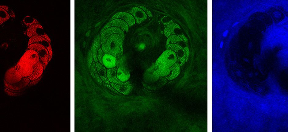 Video-rate stimulated Raman scattering (SRS) depicts the structural components of tissue&mdash;lipids (red), proteins (green), and water (blue)&mdash;in imaging the sebaceous glad wrapping around a hair in the epidermis of a mouse.