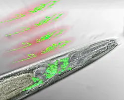 Frontal part of a nematode seen through a microscope. The neurons of the worm's 'brain' are colored in green. Above are the discs of light generated by the WF-TeFo microscope, scanning the brain area and recording the activity of certain neurons (artist's interpretation). Frontal part of a nematode seen through a microscope. The neurons of the worm's 'brain' are colored in green. Above are the discs of light generated by the WF-TeFo microscope, scanning the brain area and recording the activity of certain neurons (artist's interpretation).