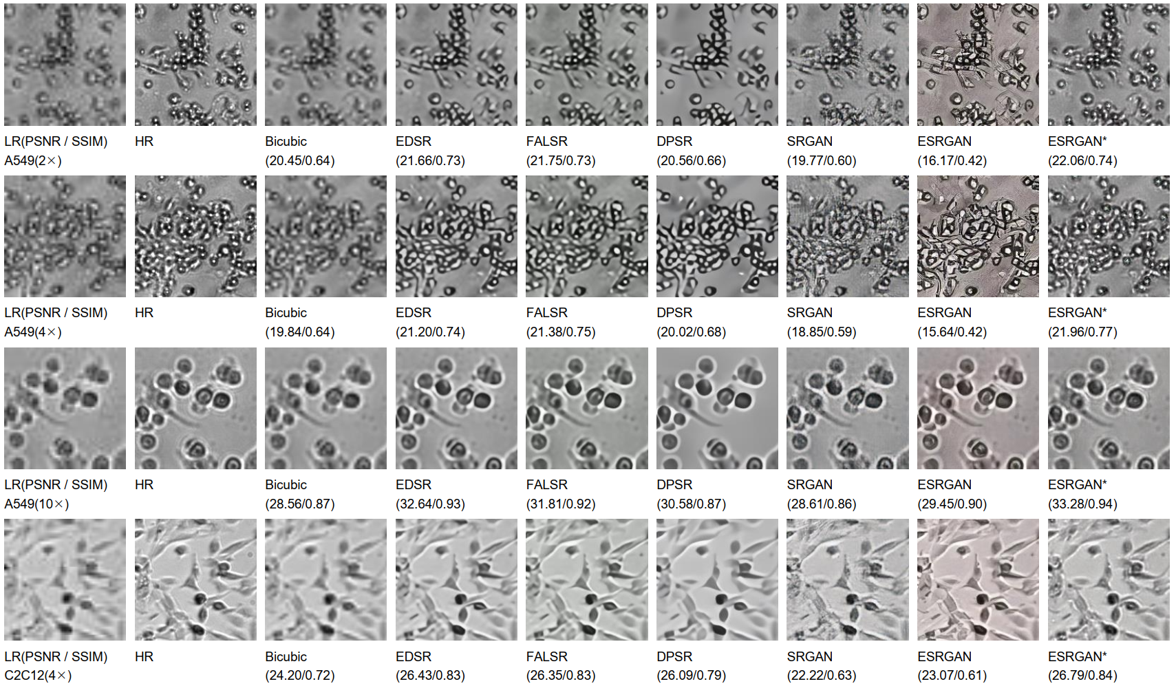 These images of human lung carcinoma cells and mouse skeletal muscle cells illustrate the performance of various resolution enhancement procedures. The left column presents low-resolution images downsampled from the high-resolution images in the second column. The new AI model results are in the right-most column, outperforming other reconstruction techniques in metrics of both accuracy and realism.
