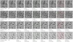 These images of human lung carcinoma cells and mouse skeletal muscle cells illustrate the performance of various resolution enhancement procedures. The left column presents low-resolution images downsampled from the high-resolution images in the second column. The new AI model results are in the right-most column, outperforming other reconstruction techniques in metrics of both accuracy and realism. These images of human lung carcinoma cells and mouse skeletal muscle cells illustrate the performance of various resolution enhancement procedures. The left column presents low-resolution images downsampled from the high-resolution images in the second column. The new AI model results are in the right-most column, outperforming other reconstruction techniques in metrics of both accuracy and realism.