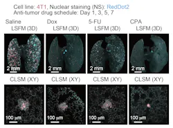 Quantitative evaluation of therapeutic effects of anti-tumor drugs in an experimental lung metastatic model: In vivo therapeutic efficacy of anti-tumor drugs. The 3D images of the lung samples are shown (4T1: mCherry, nuclei: RedDot2). Quantitative evaluation of therapeutic effects of anti-tumor drugs in an experimental lung metastatic model: In vivo therapeutic efficacy of anti-tumor drugs. The 3D images of the lung samples are shown (4T1: mCherry, nuclei: RedDot2).