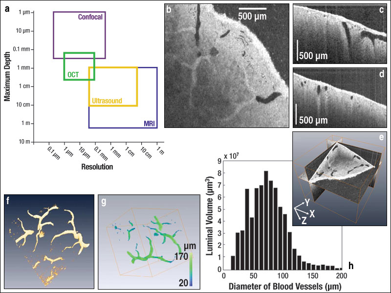 FIGURE 1. Depth and resolution are compared for various imaging techniques (a). OCT images of renal blood vessels were obtained in the X-Y (b), X-Z (c), and Y-Z (d) planes and used to construct a composite 3D image (e). Resulting depictions from visualization software include a 3D volumetric image of the segmented blood vessels (f), a measured and color-coded 3D image of the renal diameters (g), and a volume histogram of the distribution of blood-vessel diameters (h).