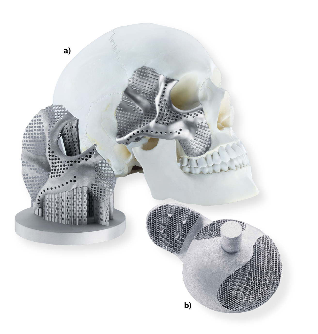 FIGURE 1. Titanium additively manufactured components are very suitable for biomedical applications, such as facial (a) and titanium hip socket (b) implants.