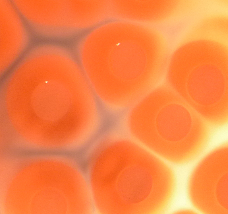 A new FTIR spectroscopy approach distinguishes aggressive strains of Staph bacteria.