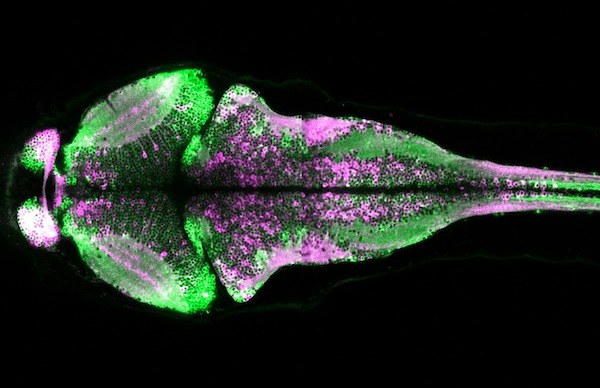 CaMPARI fluorescence in a larval zebrafish brain showing active neurons (magenta) that were marked while the fish was swimming freely.