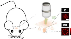 Schematic diagram of the all-optical physiology system. Green: the beam for two-photon calcium imaging. Red: the beam for two-photon optogenetics. Diagram at right: excitation pattern distributions tested with 1-micron fluorescent beads. D: disk pattern. BR: beaded ring pattern. Scale bar: 5 microns. Schematic diagram of the all-optical physiology system. Green: the beam for two-photon calcium imaging. Red: the beam for two-photon optogenetics. Diagram at right: excitation pattern distributions tested with 1-micron fluorescent beads. D: disk pattern. BR: beaded ring pattern. Scale bar: 5 microns.