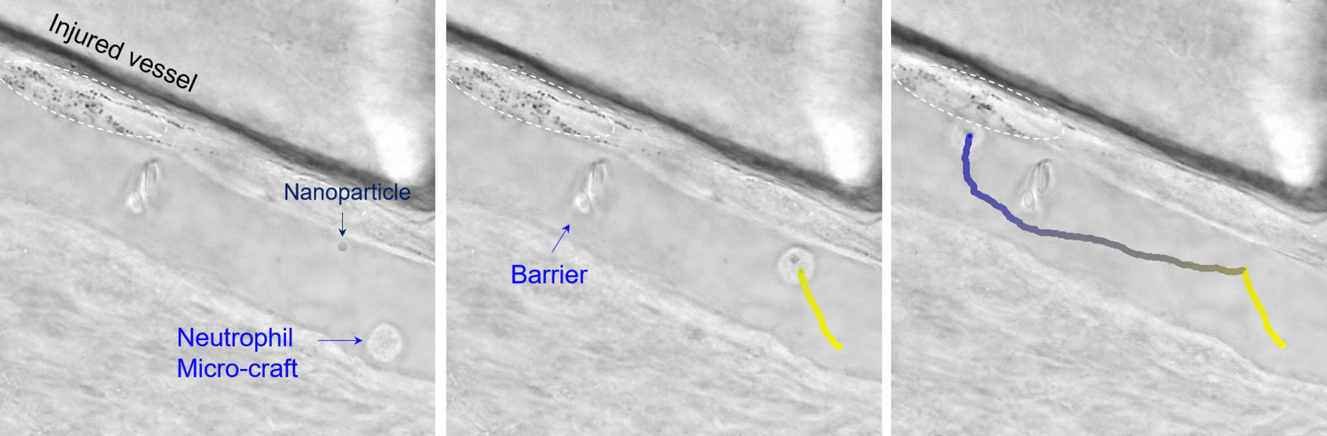 FIGURE 1. The neutrophil microcraft can carry a nanoparticle, bypass an obstacle, and then deliver it to a targeted position.