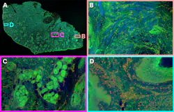 FIGURE 2. Hyperspectral images of tissue from the Giacomelli group: (a) a full centimeter-scale two-photon image of a tissue sample, false-color RGB, using signals from fluorescent stains (protein: green; DNA: red) and SHG (collagen SHG: blue); (b) a collagen-rich region; (c) a protein-rich region; and (d) a DNA-rich region, showing many cell nuclei adjacent to a blood vessel. Images were collected using TOPTICA’s FemtoFiber Ultra 920 laser for two-photon excitation. FIGURE 2. Hyperspectral images of tissue from the Giacomelli group: (a) a full centimeter-scale two-photon image of a tissue sample, false-color RGB, using signals from fluorescent stains (protein: green; DNA: red) and SHG (collagen SHG: blue); (b) a collagen-rich region; (c) a protein-rich region; and (d) a DNA-rich region, showing many cell nuclei adjacent to a blood vessel. Images were collected using TOPTICA’s FemtoFiber Ultra 920 laser for two-photon excitation.