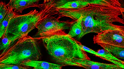 FIGURE 1. Multiphoton, or nonlinear, microscopy, uses ultrafast laser sources for capturing high-resolution three-dimensional (3D) images with reduced photobleaching and phototoxicity compared to traditional confocal microscopy techniques. However, pulse spreading can make multiphoton microscopy images like this one become blurry. FIGURE 1. Multiphoton, or nonlinear, microscopy, uses ultrafast laser sources for capturing high-resolution three-dimensional (3D) images with reduced photobleaching and phototoxicity compared to traditional confocal microscopy techniques. However, pulse spreading can make multiphoton microscopy images like this one become blurry.