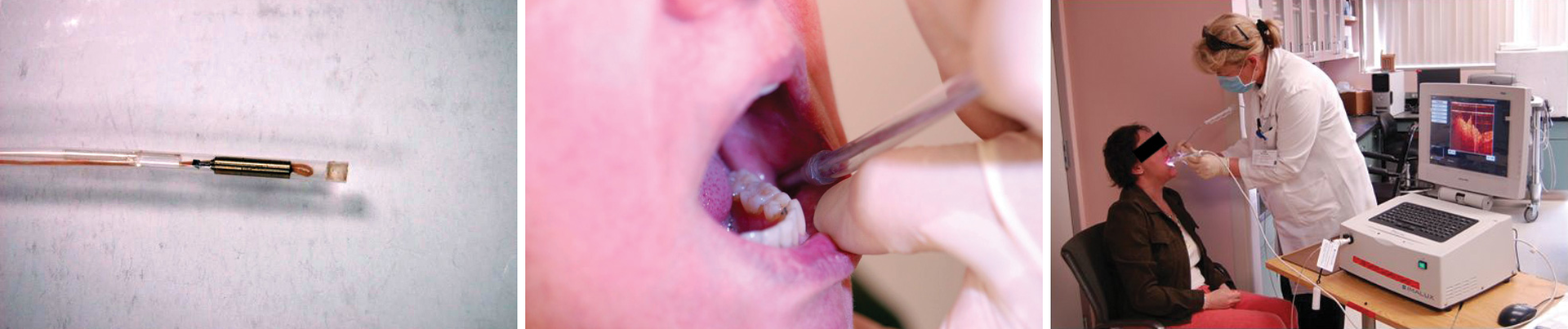 FIGURE 1. The fiber-optic probe (left) is small enough to enable intra-oral imaging (center), and the display makes easily visible the output of the probe (right).
