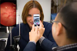 A potential mHealth application is for noninvasive blood hemoglobin quantification and oxygen saturation levels. The easily accessible inner eyelid (palpebral conjunctiva) is used as a sensing site (inset). A potential mHealth application is for noninvasive blood hemoglobin quantification and oxygen saturation levels. The easily accessible inner eyelid (palpebral conjunctiva) is used as a sensing site (inset).