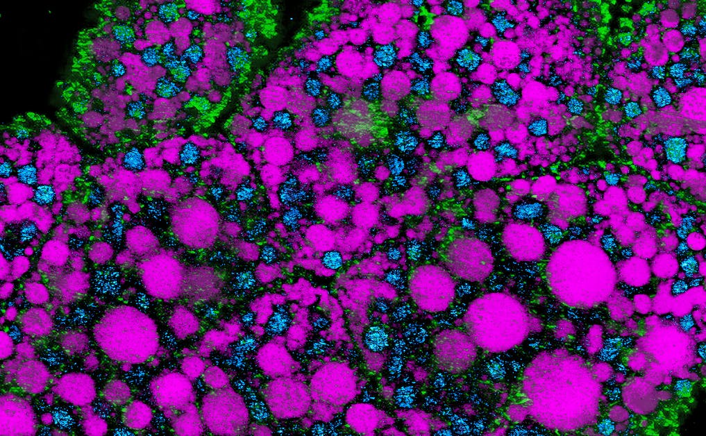 Structures containing different lipid subtypes in the fat body tissue in a fruit fly. Each lipid subtype has a different molecular composition represented by a different color.
