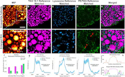 PRM-SRS imaging of Drosophila fat body cells detects different lipid subtypes and their subcellular distributions. PRM-SRS imaging of Drosophila fat body cells detects different lipid subtypes and their subcellular distributions.