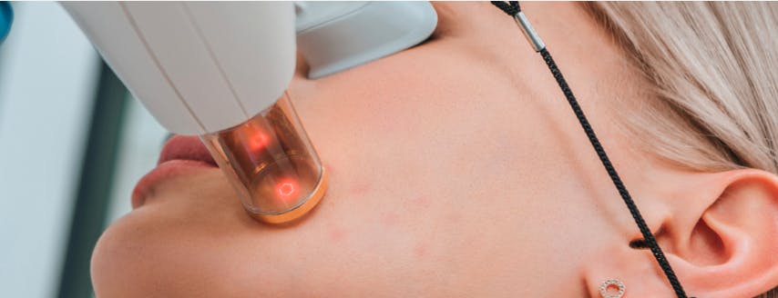 Transforming Skincare with Laser Optics