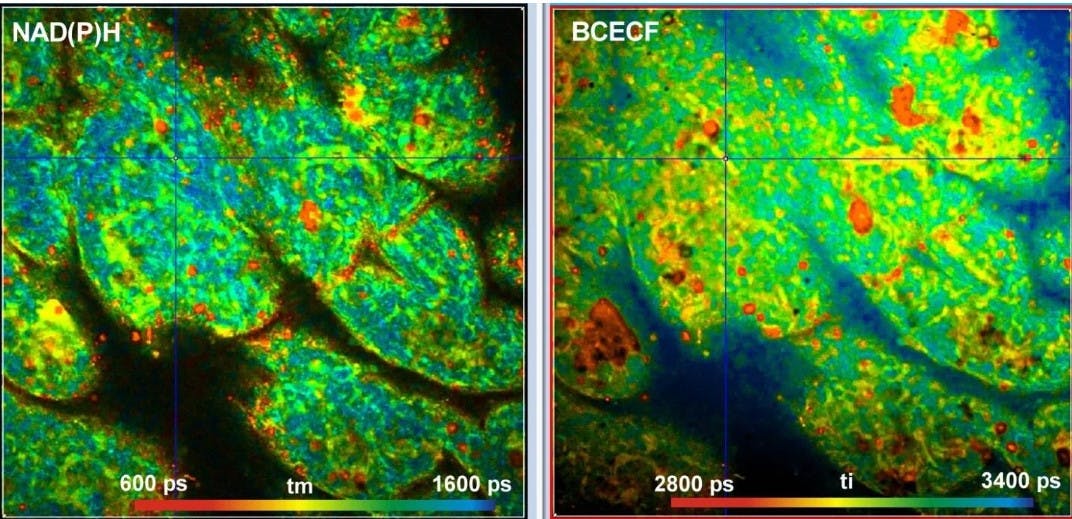 Metabolic FLIM with Simultaneous pH Imaging