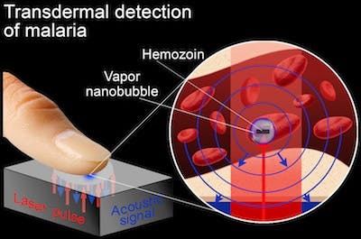 67abbee00ffcc4d839f24901 Content Dam Lfw Online Articles 2013 12 Rice Malar