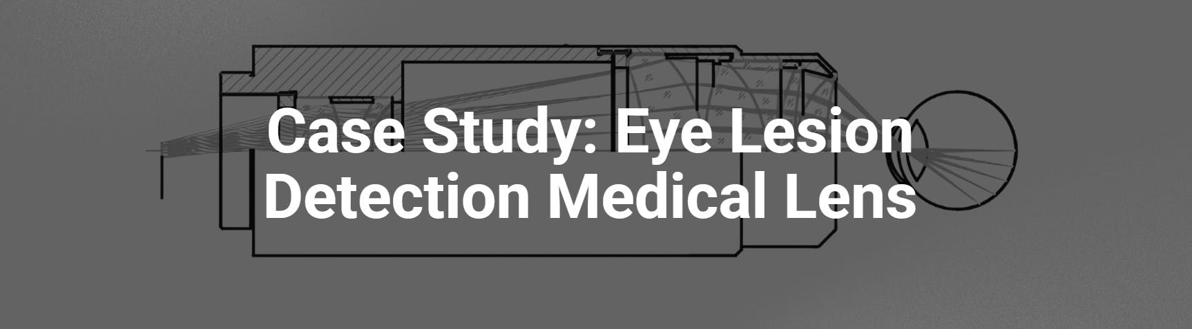 Case Study: Eye Lesion Detection Medical Lens | Laser Focus World